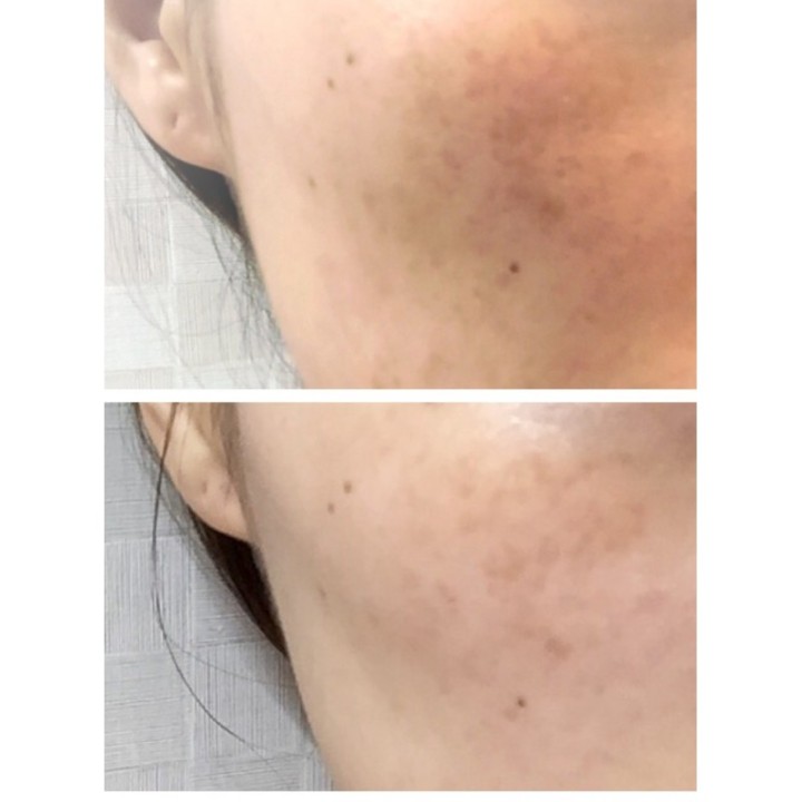 SK-II - Esencia Genoptics Aura